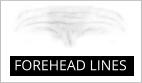 FOREHEAD LINES
