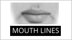 MOUTH LINES