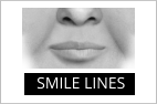 SMILE LINES