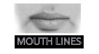 MOUTH LINES